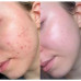 Тонер-пaди для обличчя з саліциловою кислотою Dr. Althea 2% Salicylic Acid Clear Pad, 60шт Тонер-пaди для обличчя з саліциловою кислотою Dr. Althea 2% Salicylic Acid Clear Pad, 60шт