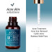 Сироватка проти акне Cos de Baha Acne Treatment Serum Azelaic acid 5%, Hinokitiol, Niacinamide 10%, Salicylic Acid, Retinol, Tea Tree, 30мл